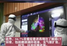 新冠后遗症:一年后仍呼吸急促-2021电话无限轰炸手机版-骚扰神器24小时轰炸免费-永久免费轰炸电话网页版